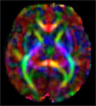 Fetal Diffusion Atlas Color-FA