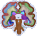 Fetal Brain Segmentation