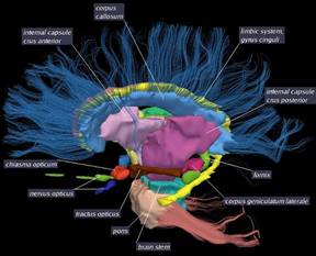 Multiple Sclerosis Atlas of White Matter Fiber Tracts